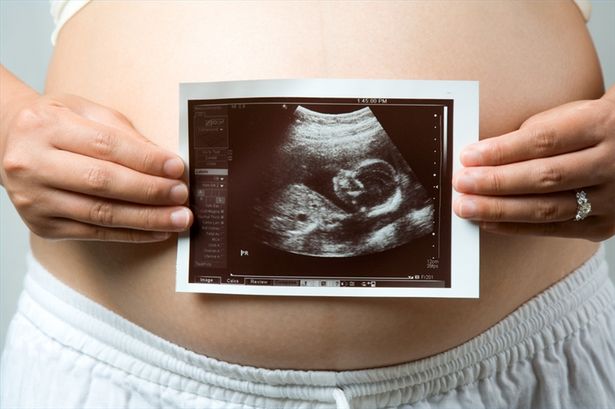 ovarios poliquisticos y embarazo